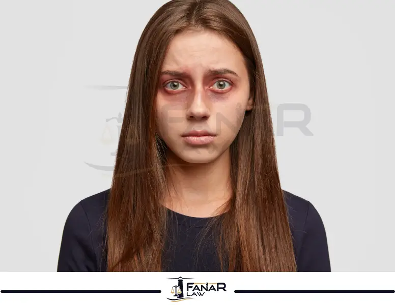 عقوبة العنف ضد المرأة في تركيا